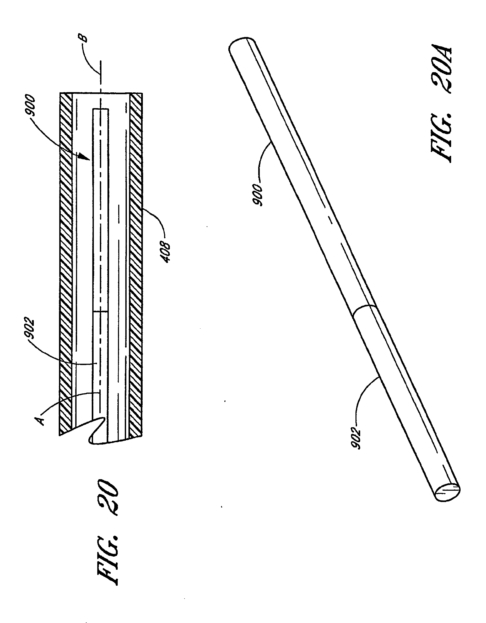 devices for closing a patent foramen ovale
