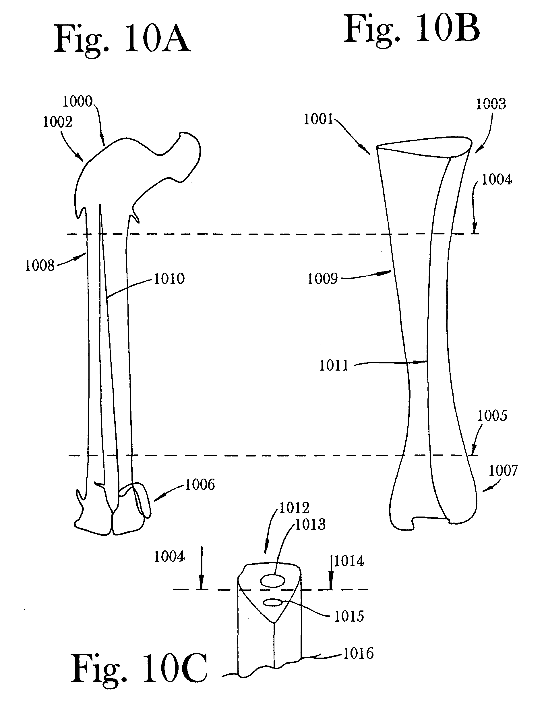 cortical bone cervical smith-robinson fusion implant