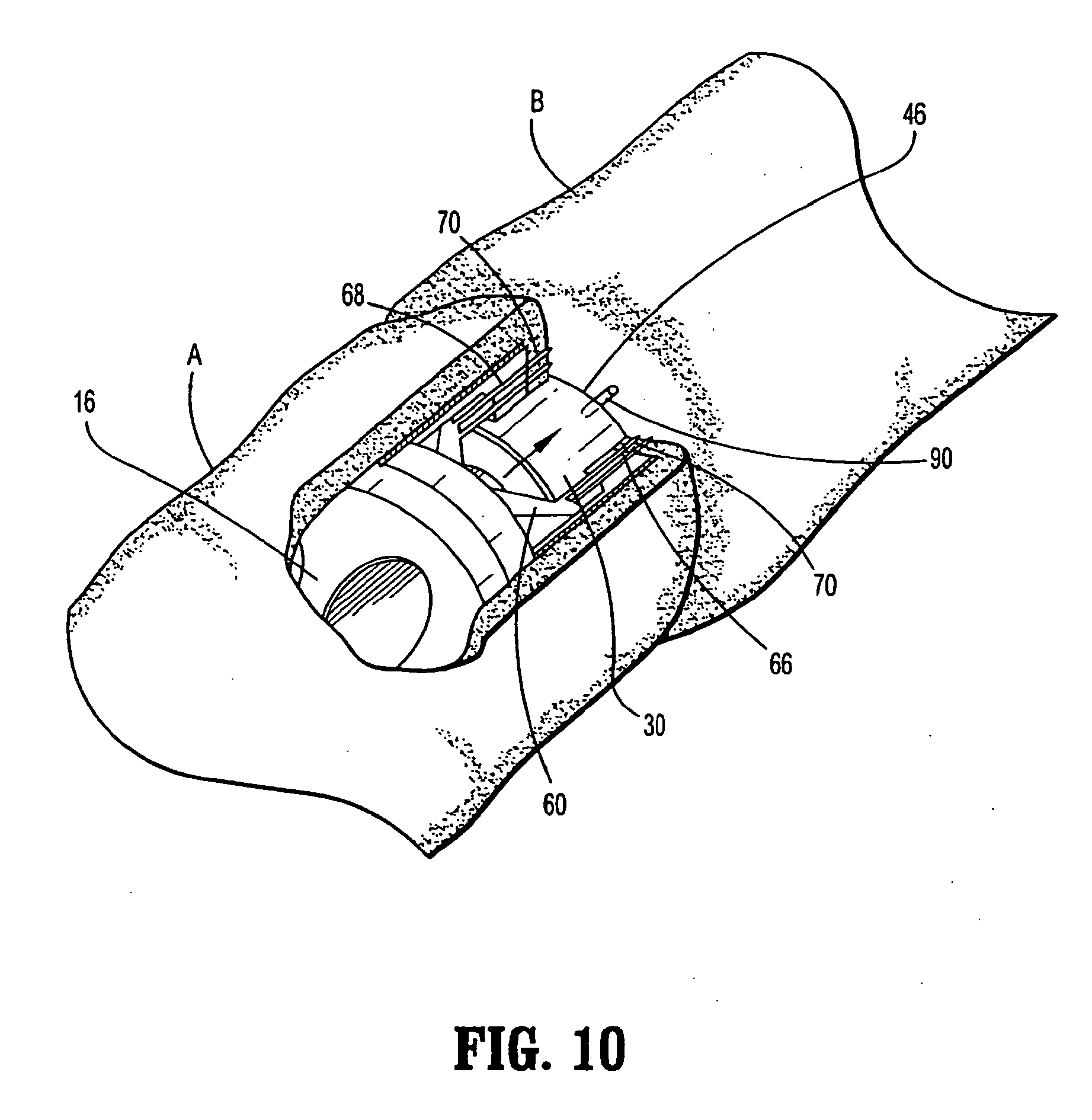 Patent EP2030578B1 Rotary knife cutting systems Google Patents