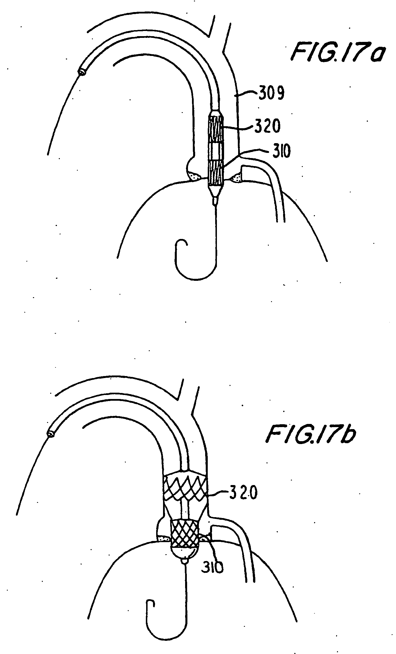 Patent EP2055266B1 - Implantable prosthetic valve - Google Patents