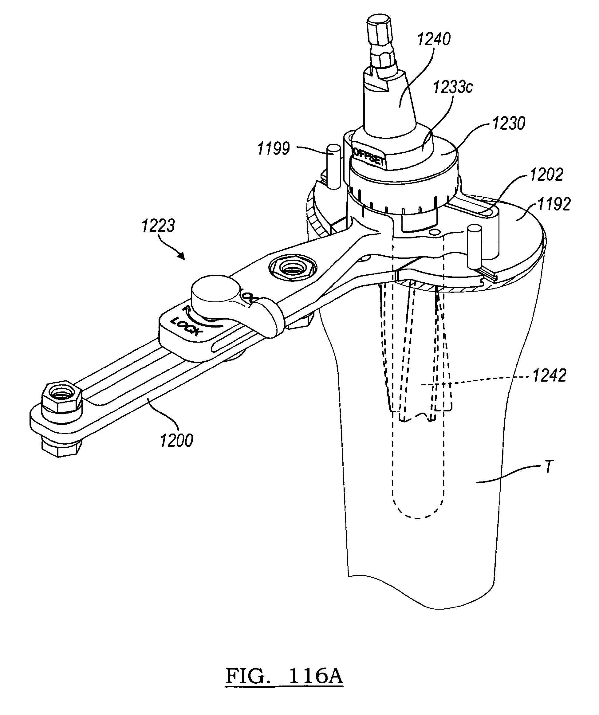 knee joint prosthesis system
