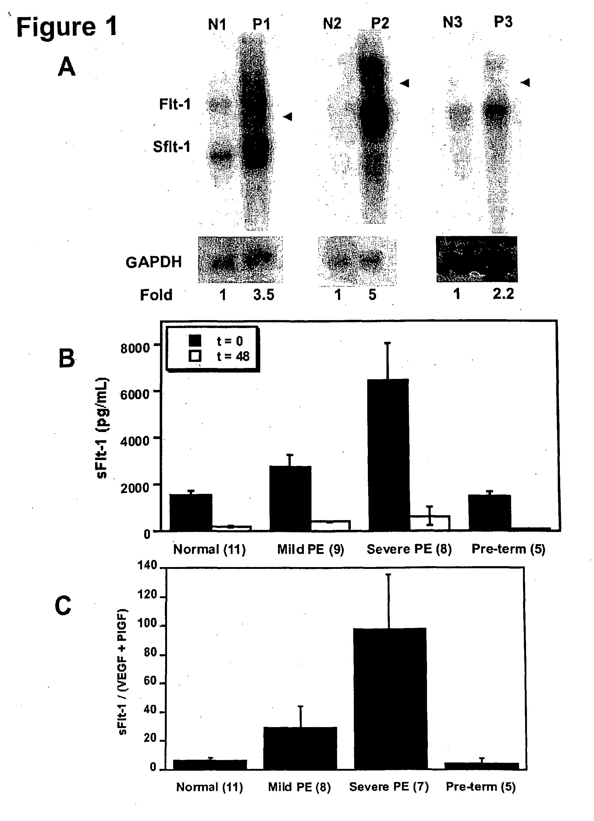 methods of diagnosing and treating pre-eclampsia or eclampsia
