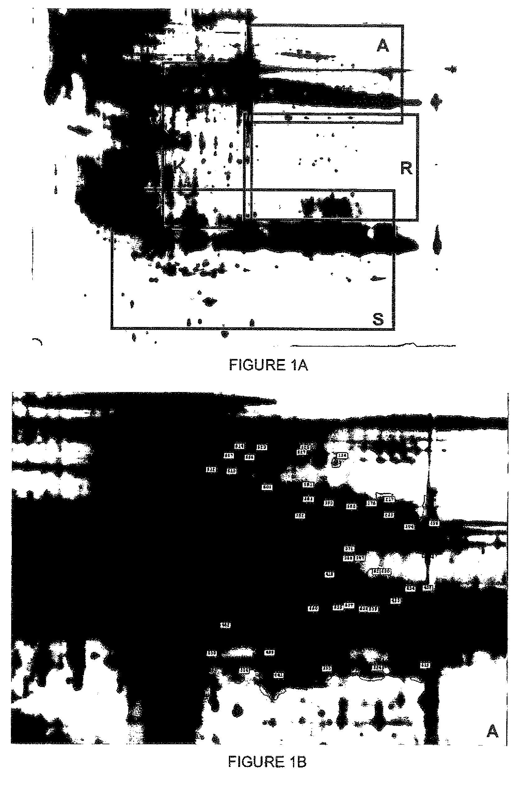 non-invasive in vitro method to detect transitional cell