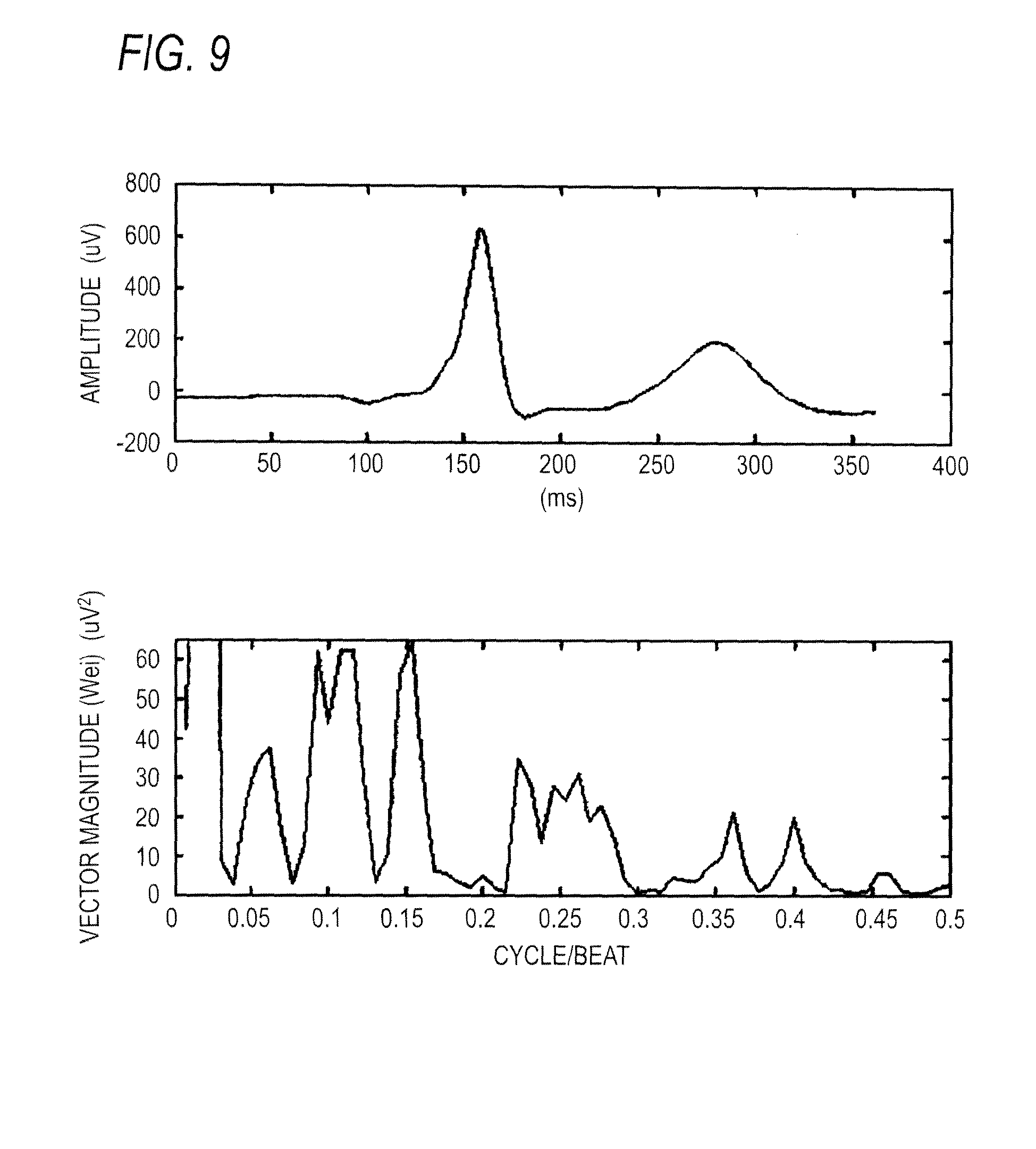 twa measuring electrocardiograph, twa measuring meth