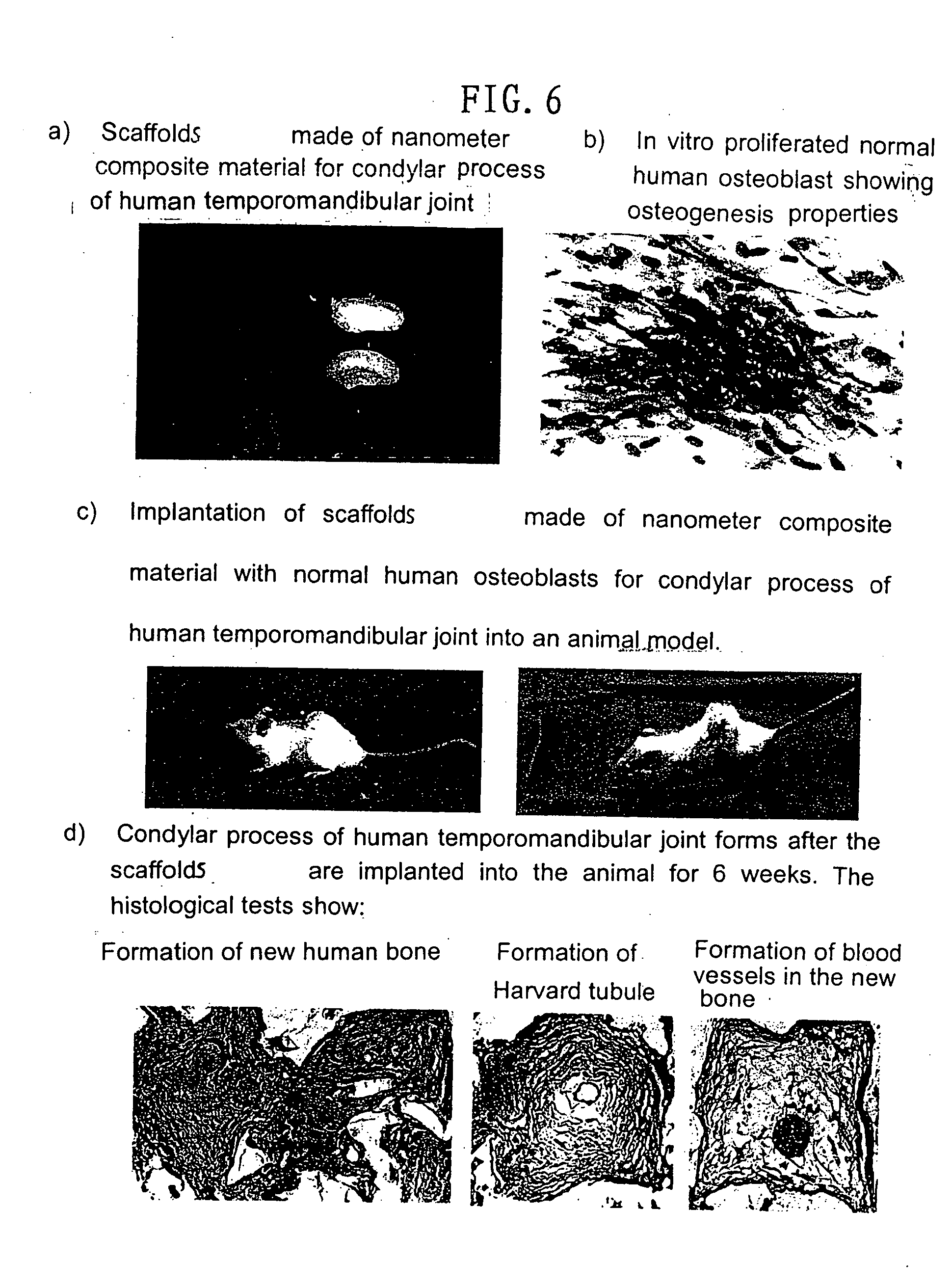 introduction to bone tissue engineering Hydrogels in bone tissue engineering introduction bone injuries can result in patient morbidity and even mortality in the absence of effective healing. introduction to bone tissue engineering Hydrogels in bone tissue engineering introduction bone injuries can result in patient morbidity and even mortality in the absence of effective healing.