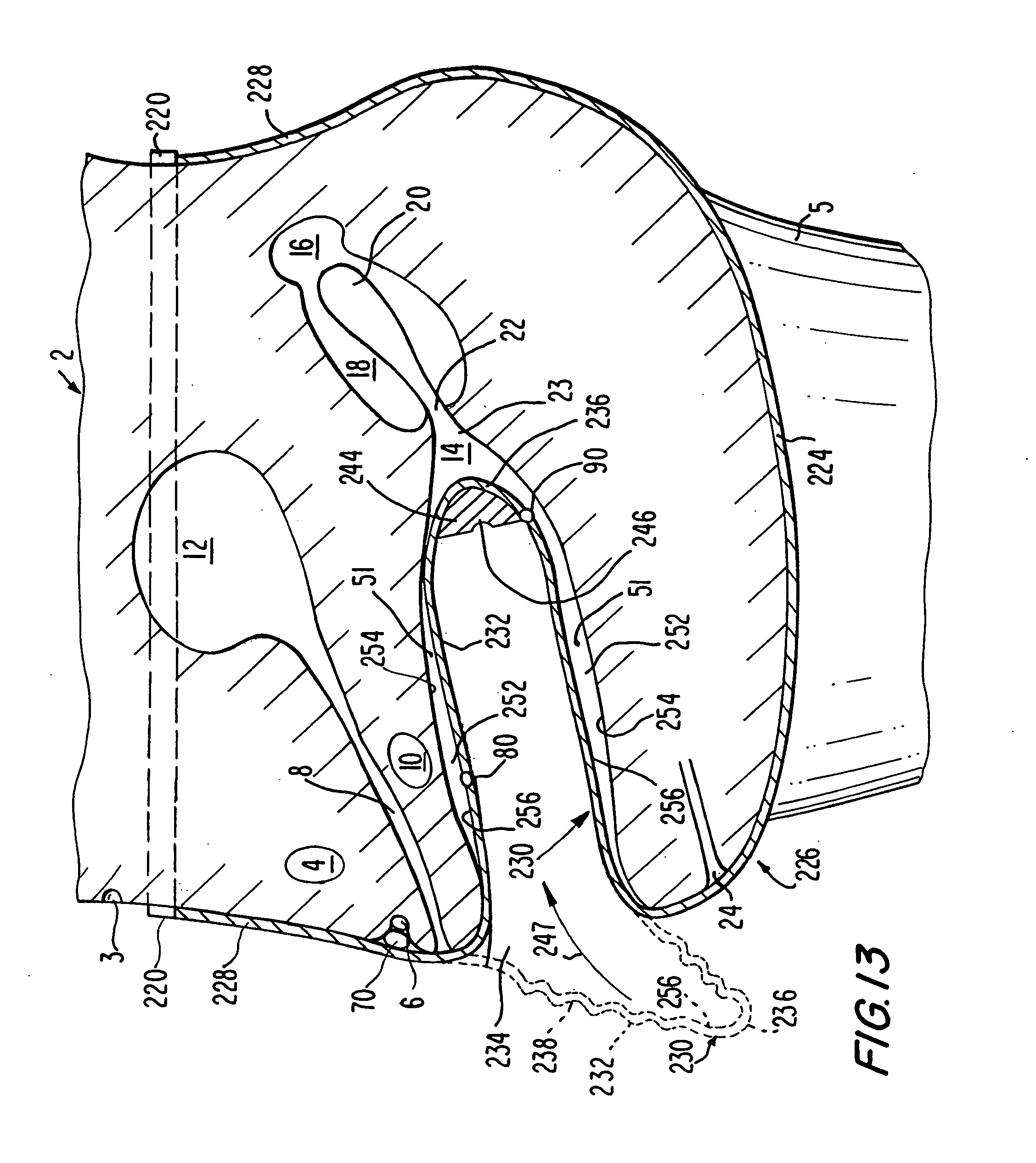 Patent Us20060231104 Female Barrier Contraceptive With Vacuum