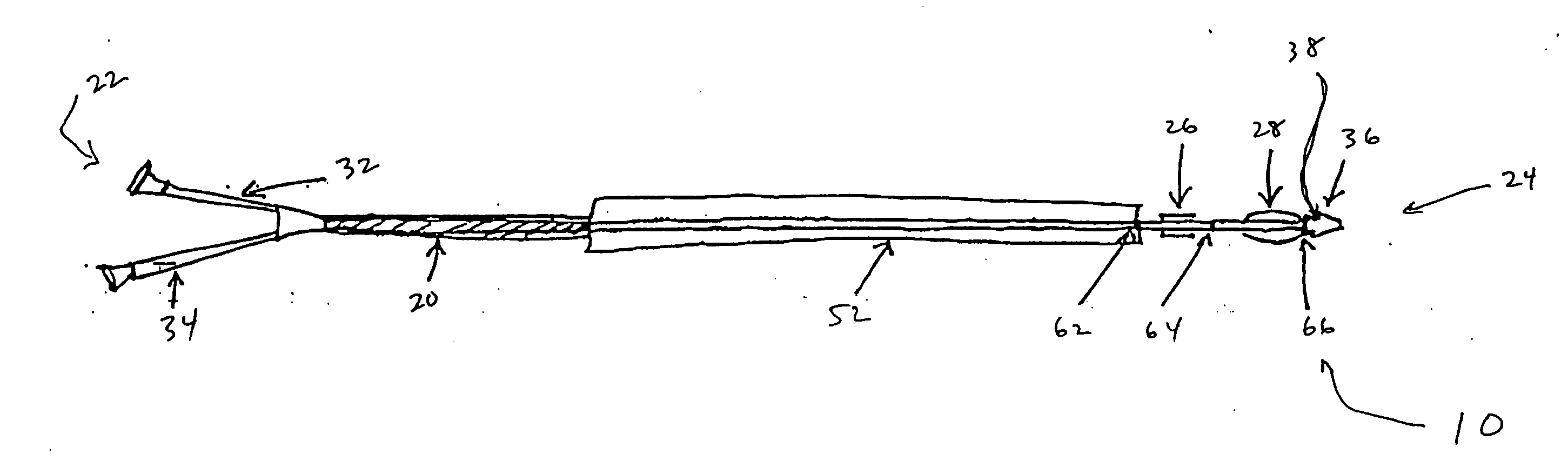 stent alvleesklier