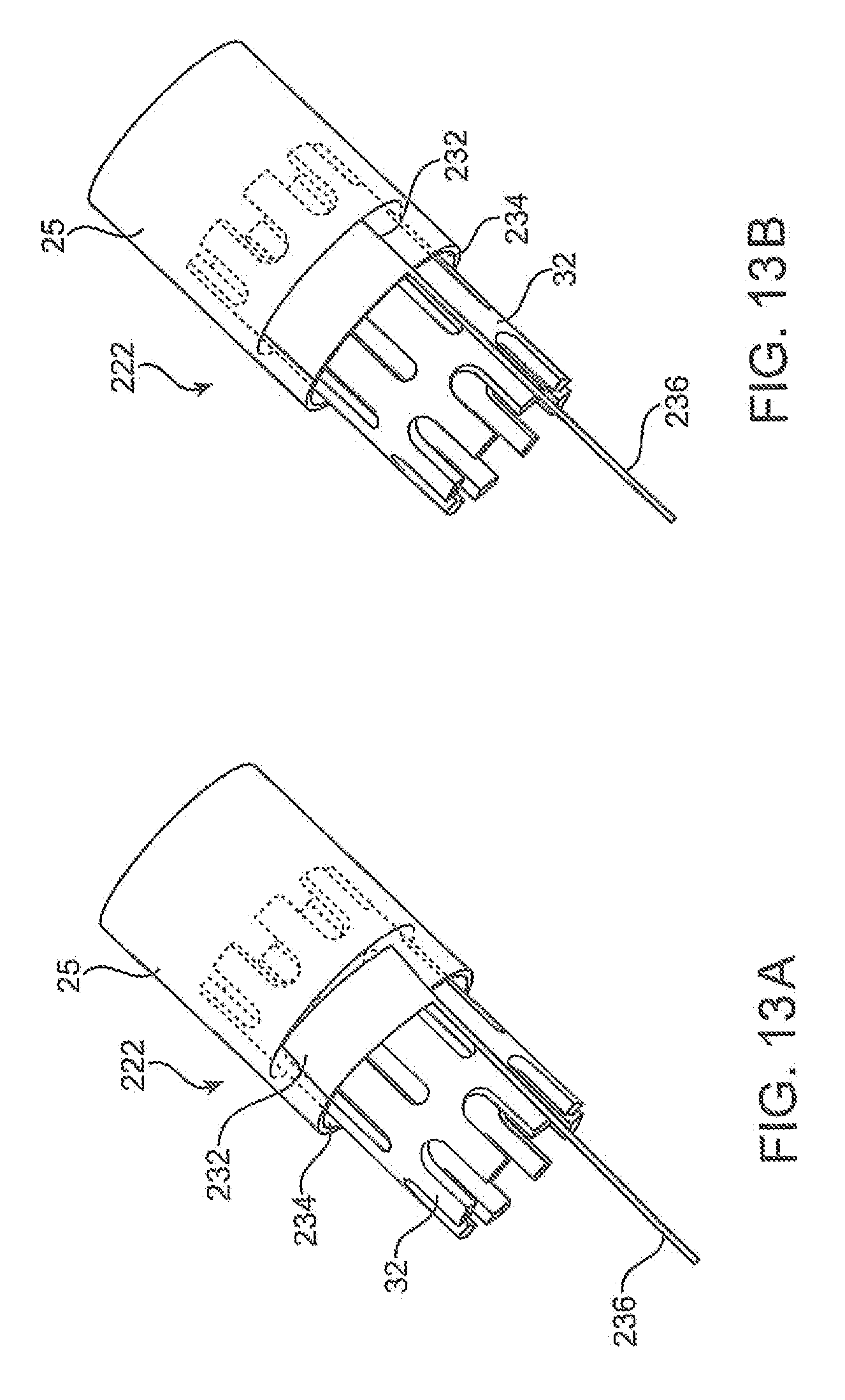 catheter prothesis catheter prothesis