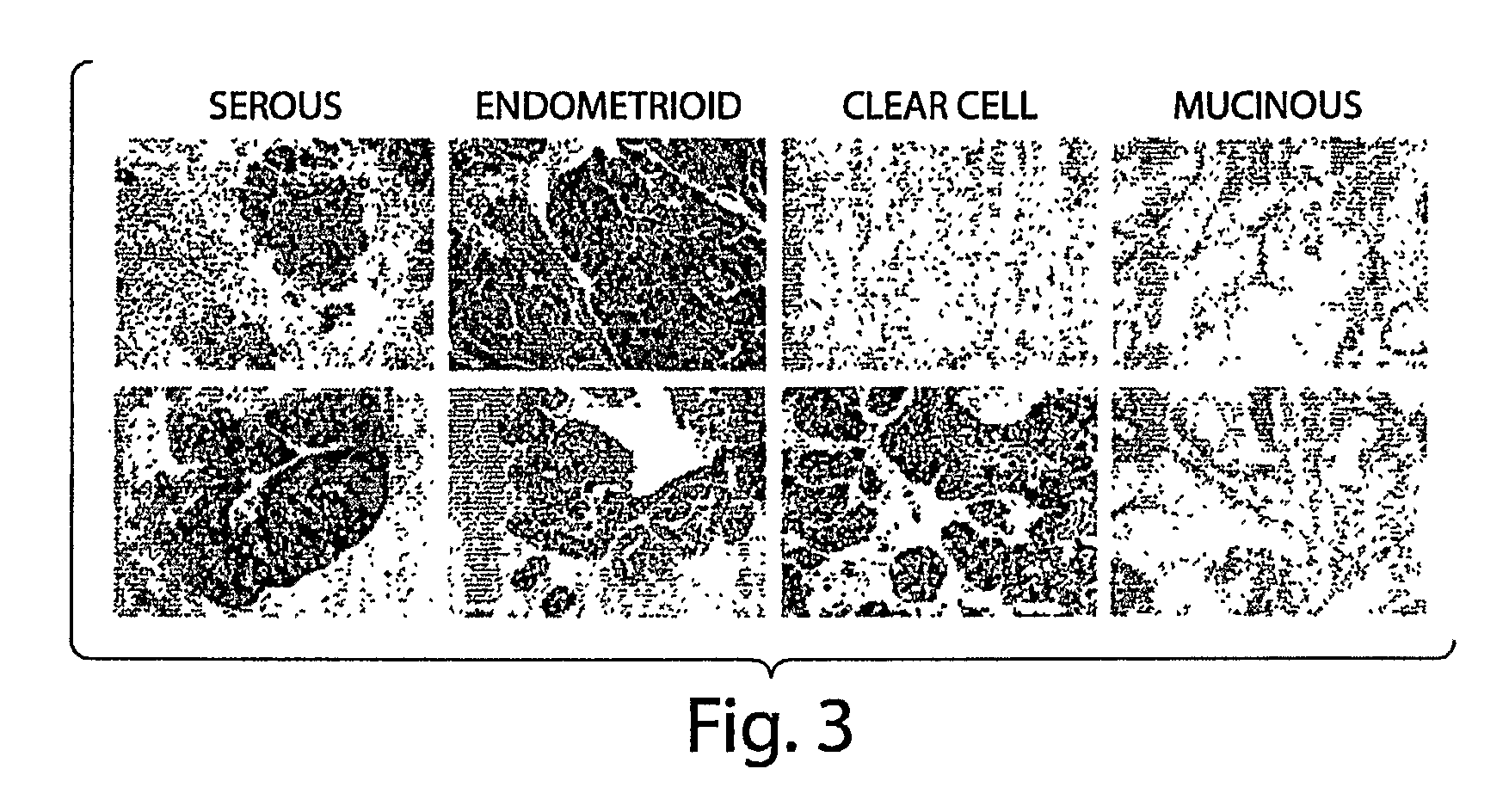methods of detecting cancer Engineering researchers at the university of arkansas have moved closer to developing an alternative method of detecting and possibly treating breast cancer. methods of detecting cancer Engineering researchers at the university of arkansas have moved closer to developing an alternative method of detecting and possibly treating breast cancer.