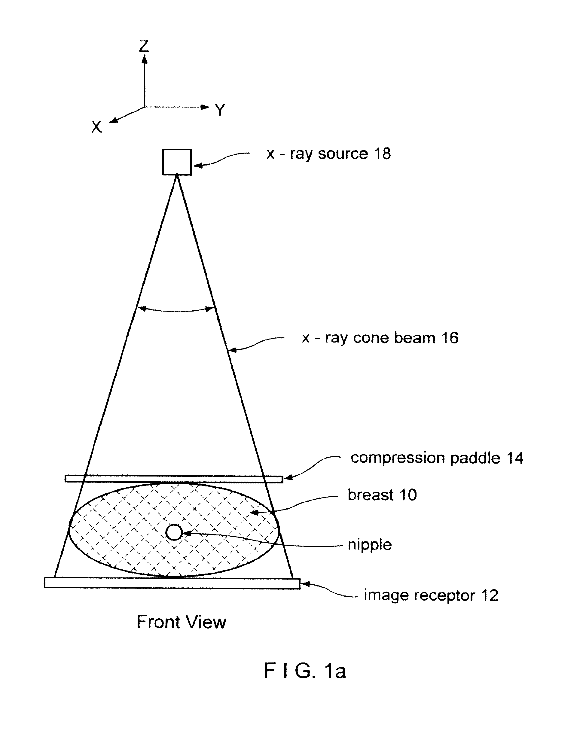 tomosynthesis images Purpose: to describe and evaluate a method of tomosynthesis breast imaging with a full-field digital mammographic system materials and methods: in this tomosynthesis method, low-radiation-dose images were acquired as the x-ray source was moved in an arc above the stationary breast and digital . tomosynthesis images Purpose: to describe and evaluate a method of tomosynthesis breast imaging with a full-field digital mammographic system materials and methods: in this tomosynthesis method, low-radiation-dose images were acquired as the x-ray source was moved in an arc above the stationary breast and digital .