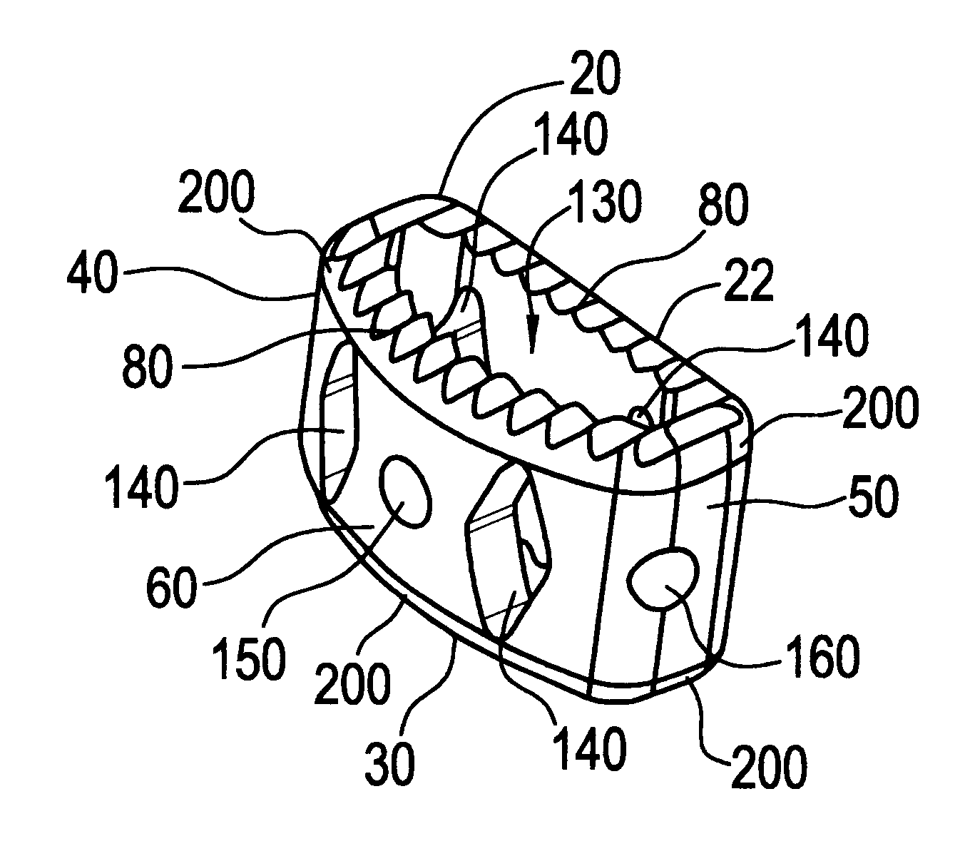 spinal prothesis brantigan cages The introduction of titanium cages for the purpose of spinal “fusion” opened an important new era in spine stabilization not only have titanium cages, when. spinal prothesis brantigan cages The introduction of titanium cages for the purpose of spinal “fusion” opened an important new era in spine stabilization not only have titanium cages, when.