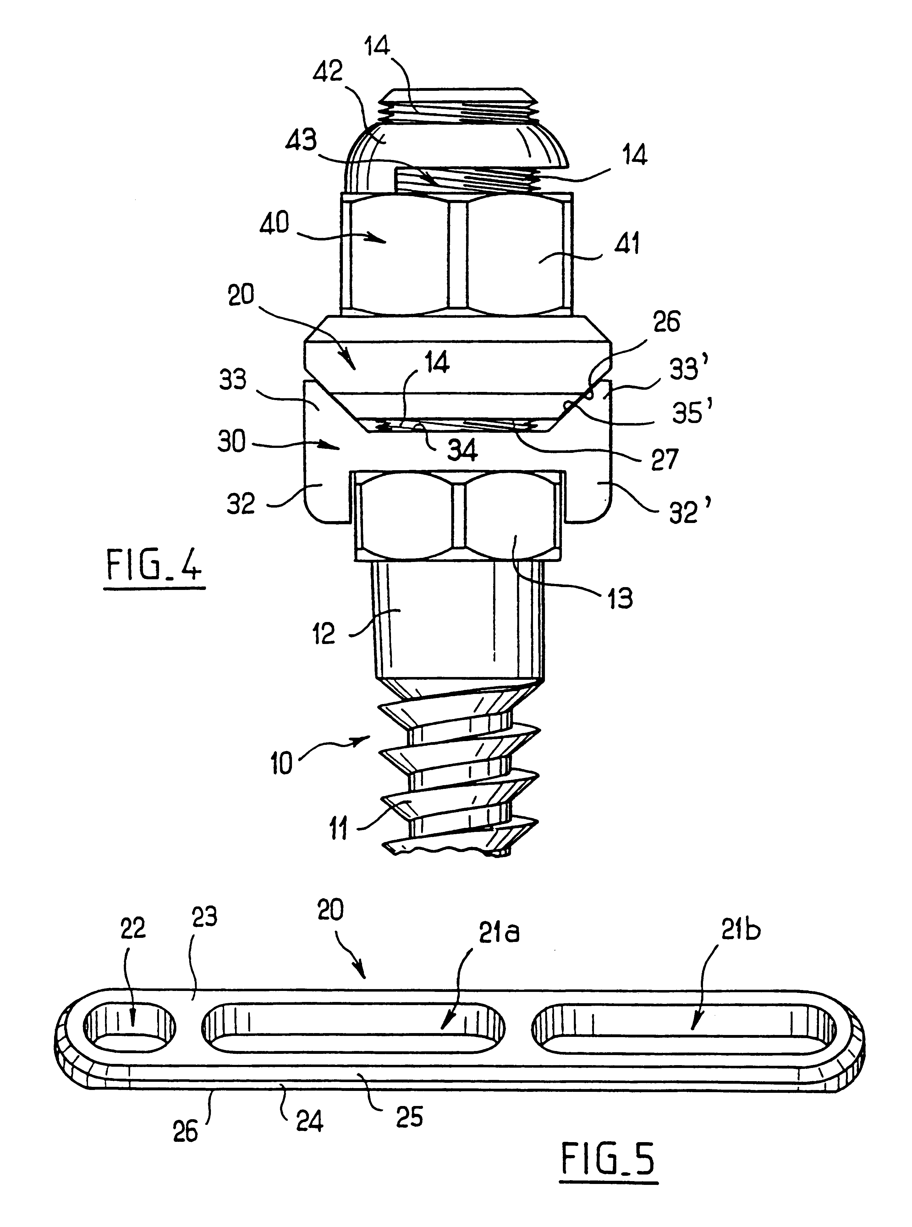Osteosynthesis plates screws