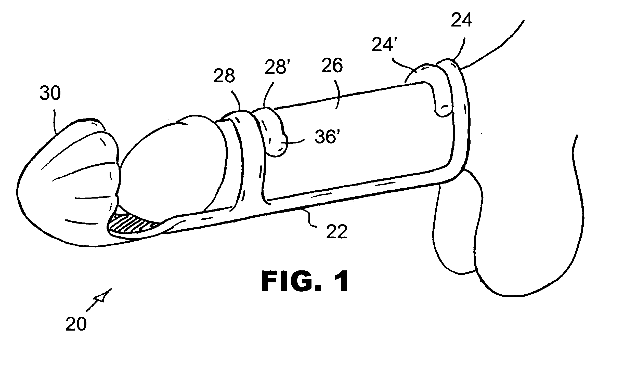 Define patent anus final, sorry Define patent anus excited too