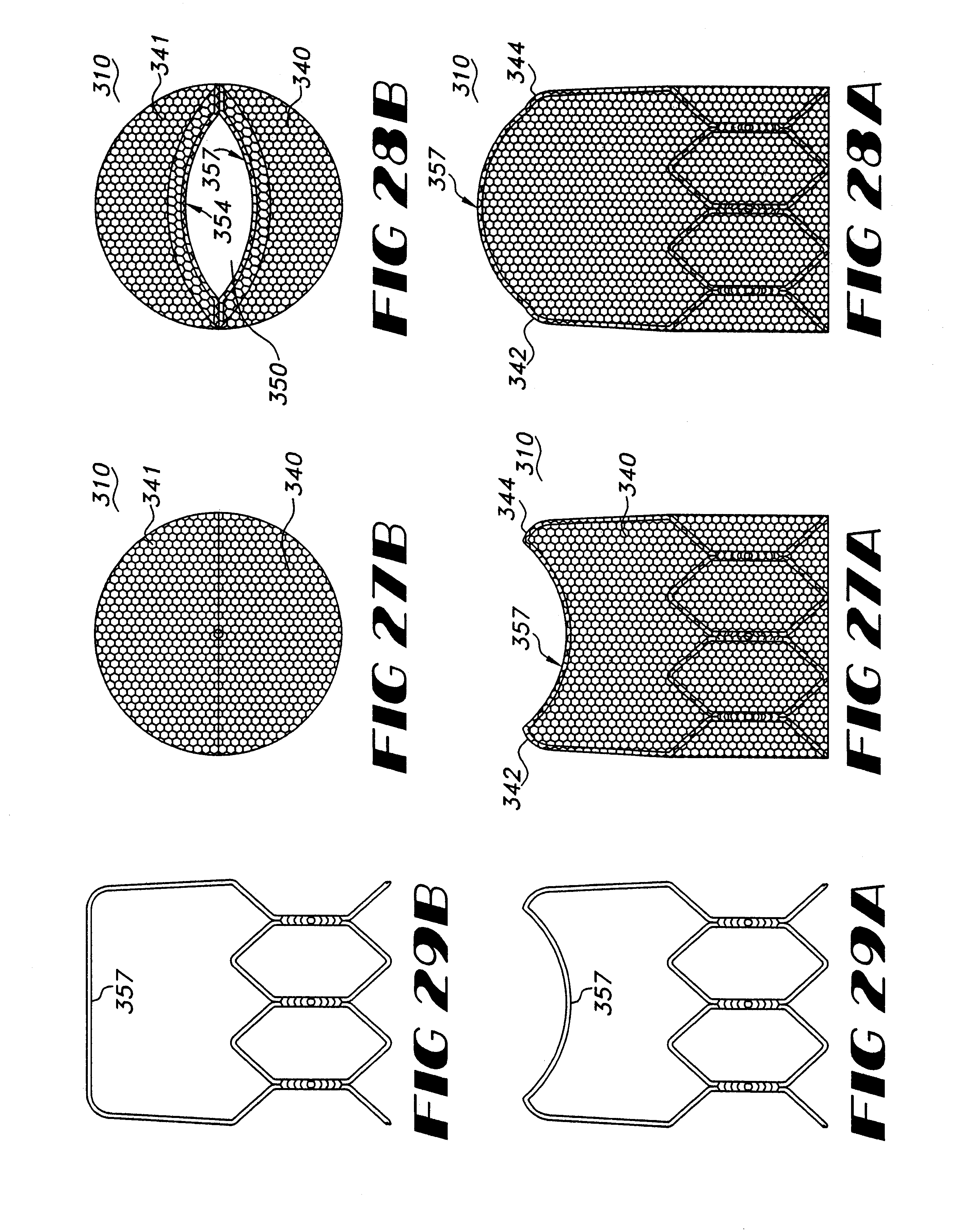 Patent US6685739 - Implantable prosthetic valve - Google Patents