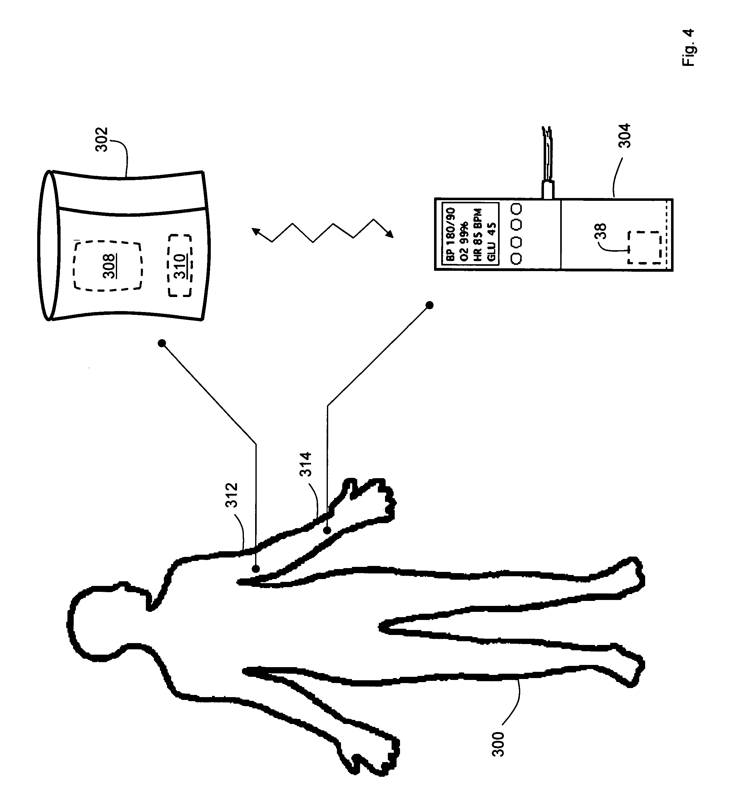an analysis of the method of measuring arterial blood pressure Comparison of continuous arterial pressure waveform analysis with the the 2 methods for measuring co uous relationship between arterial pressure and blood. an analysis of the method of measuring arterial blood pressure Comparison of continuous arterial pressure waveform analysis with the the 2 methods for measuring co uous relationship between arterial pressure and blood.
