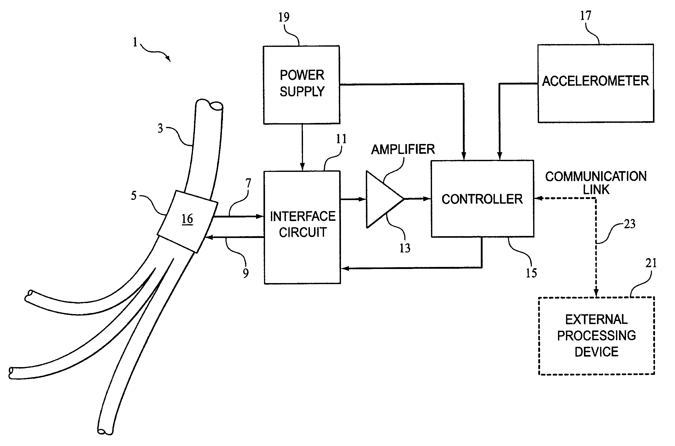 method and apparatus for hypoglossal nerve stimulation