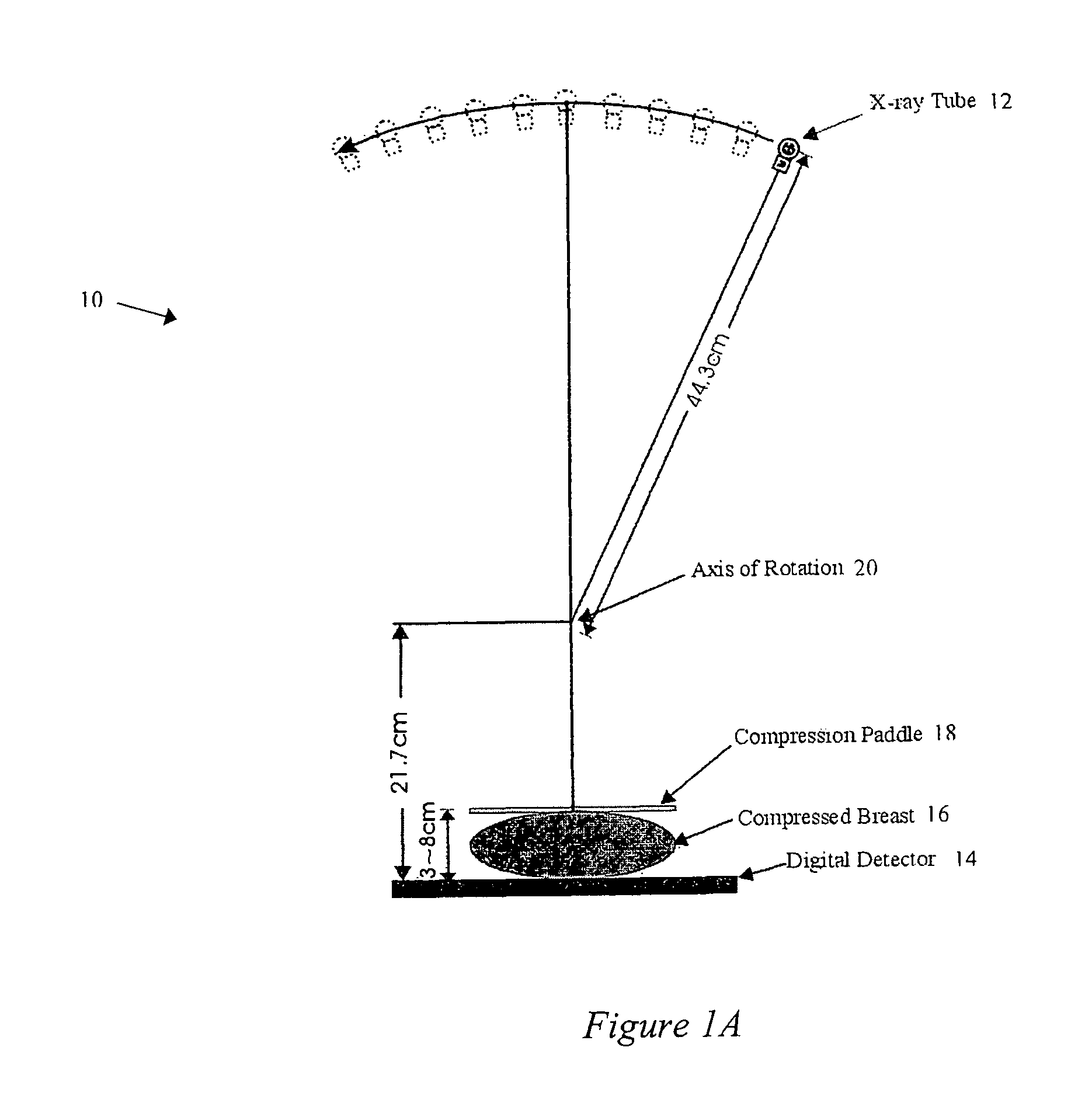 tomosynthesis reconstruction In this paper, a fast, accurate and memory-saving tomosynthesis algorithm is presented based on the algebraic reconstruction technique (art) in this approach, a one. tomosynthesis reconstruction In this paper, a fast, accurate and memory-saving tomosynthesis algorithm is presented based on the algebraic reconstruction technique (art) in this approach, a one.