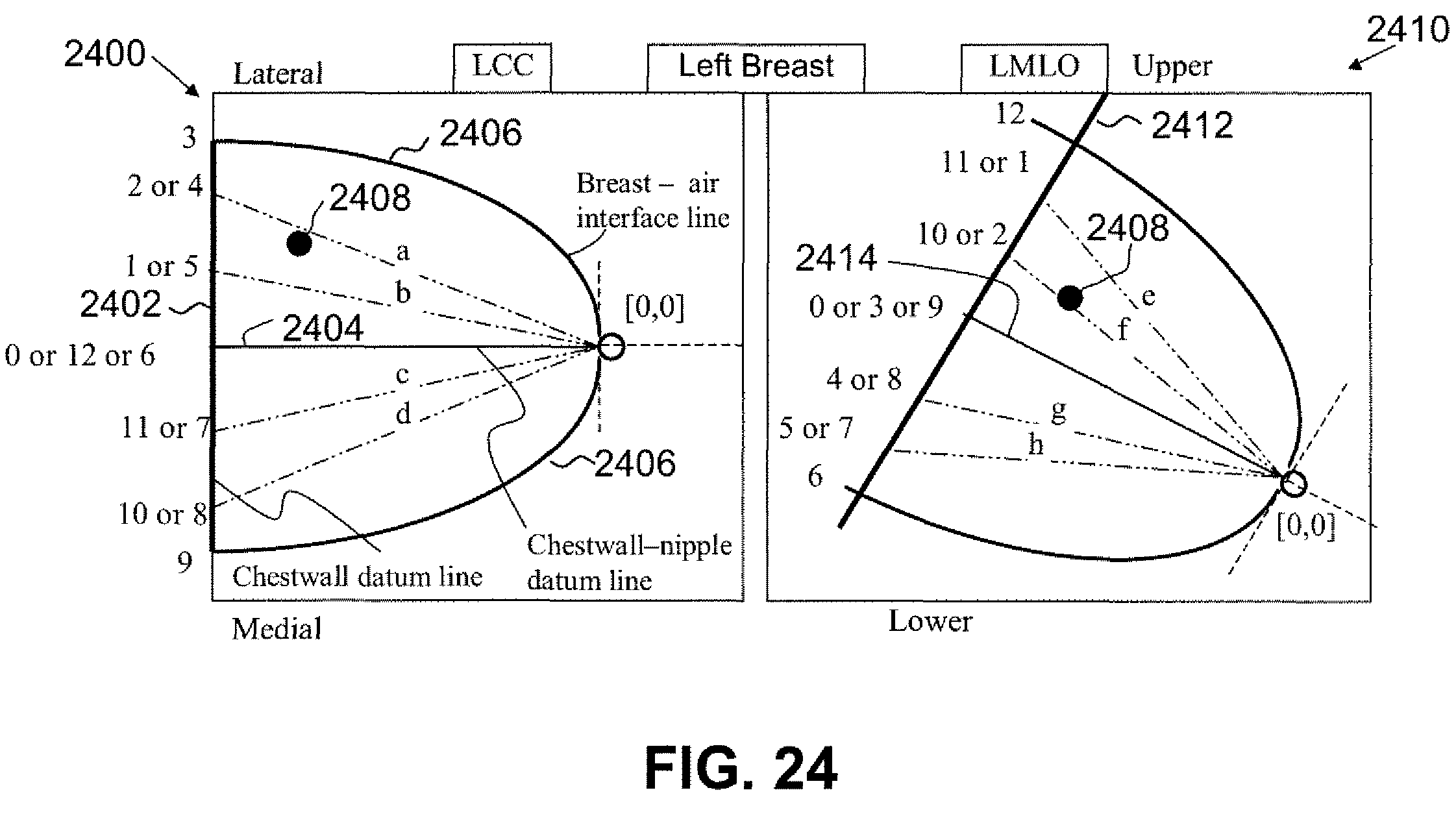 Patent Us7865002 Methods And Apparatus For Computer Automated