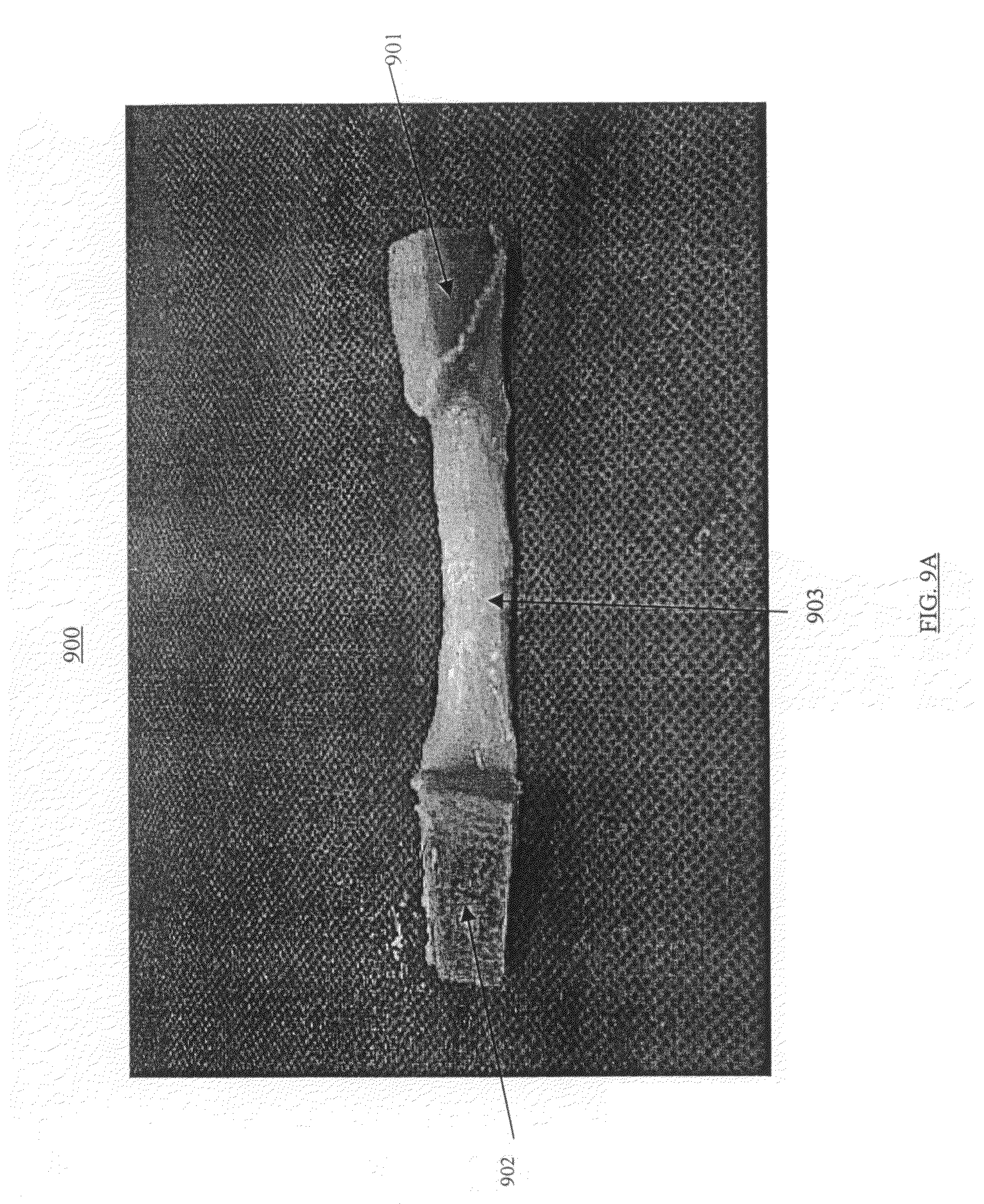 xenograft bone transplantation method essay xenograft bone transplantation method essay