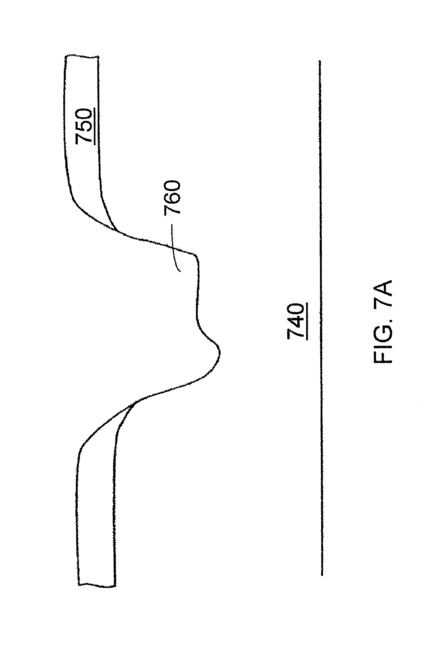 implants and methods for performing gingiva and bone