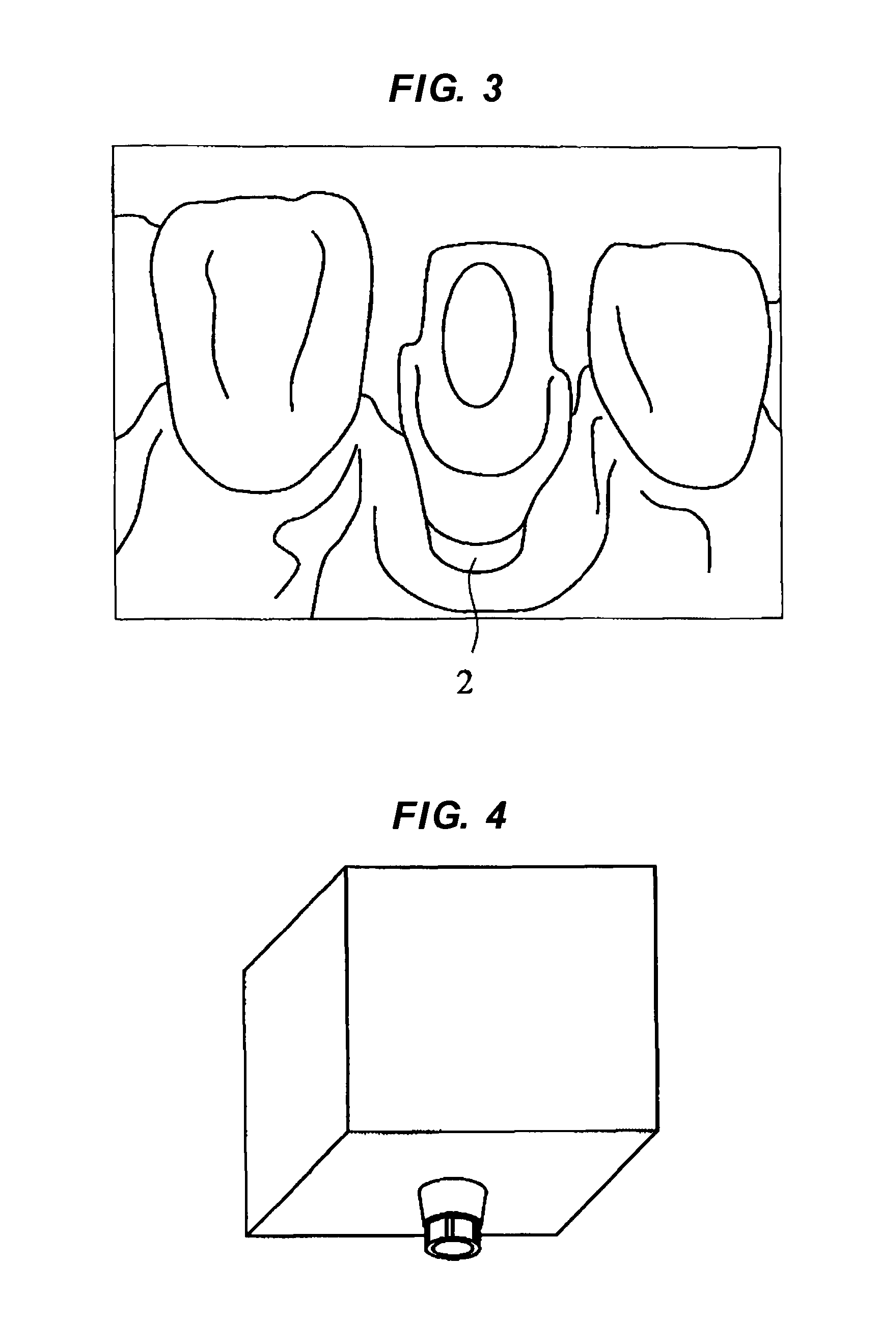wax model base for abutment of dental implant