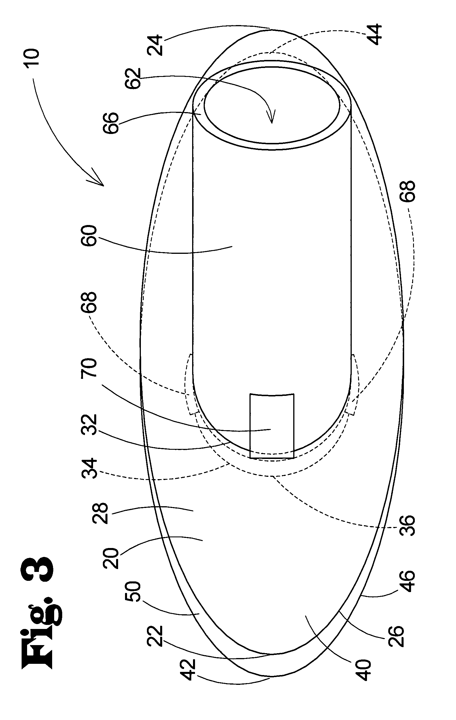 vascular anastomosis