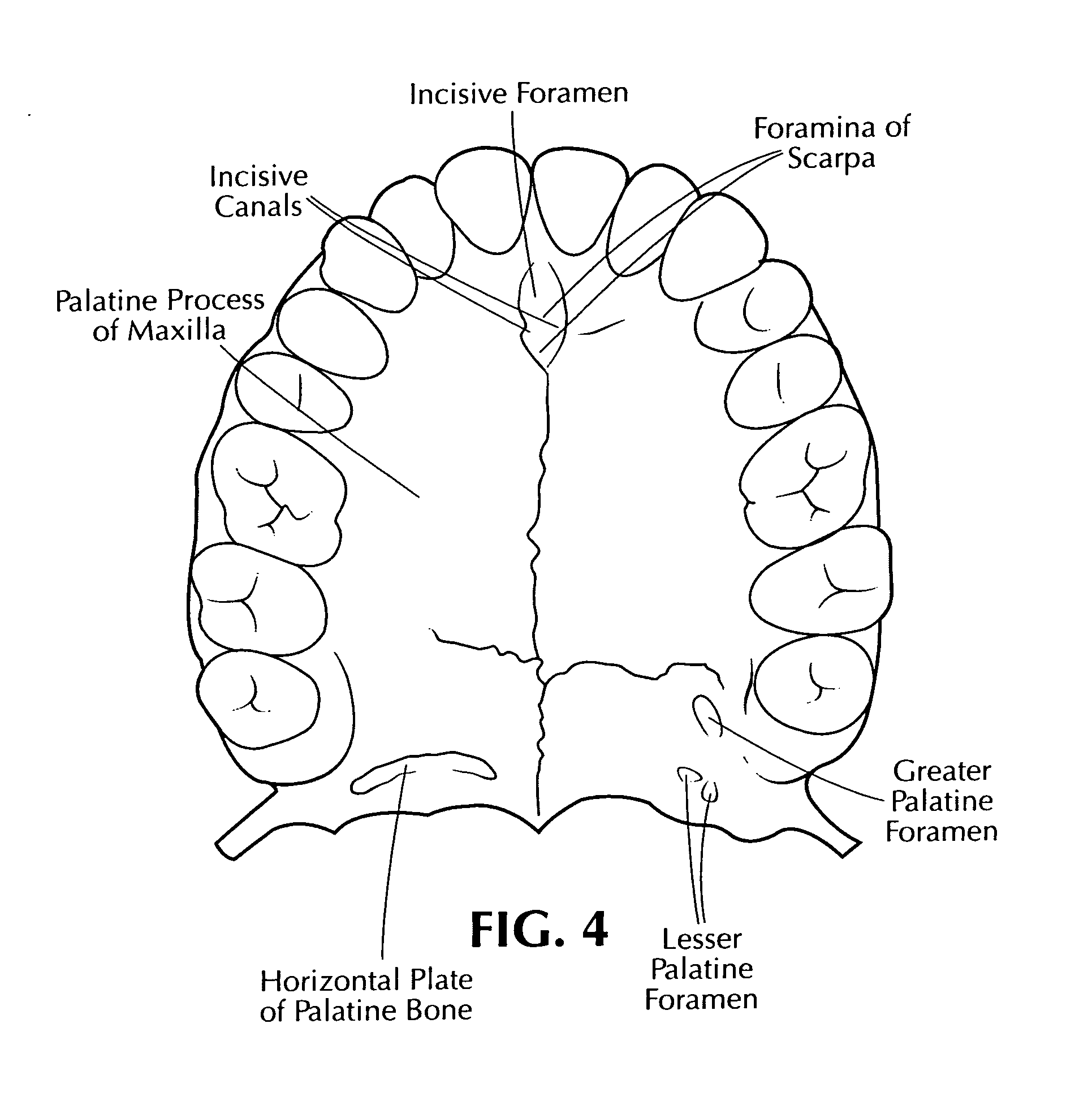 Patent US8376754 Training aid for a dental injection Google Patents