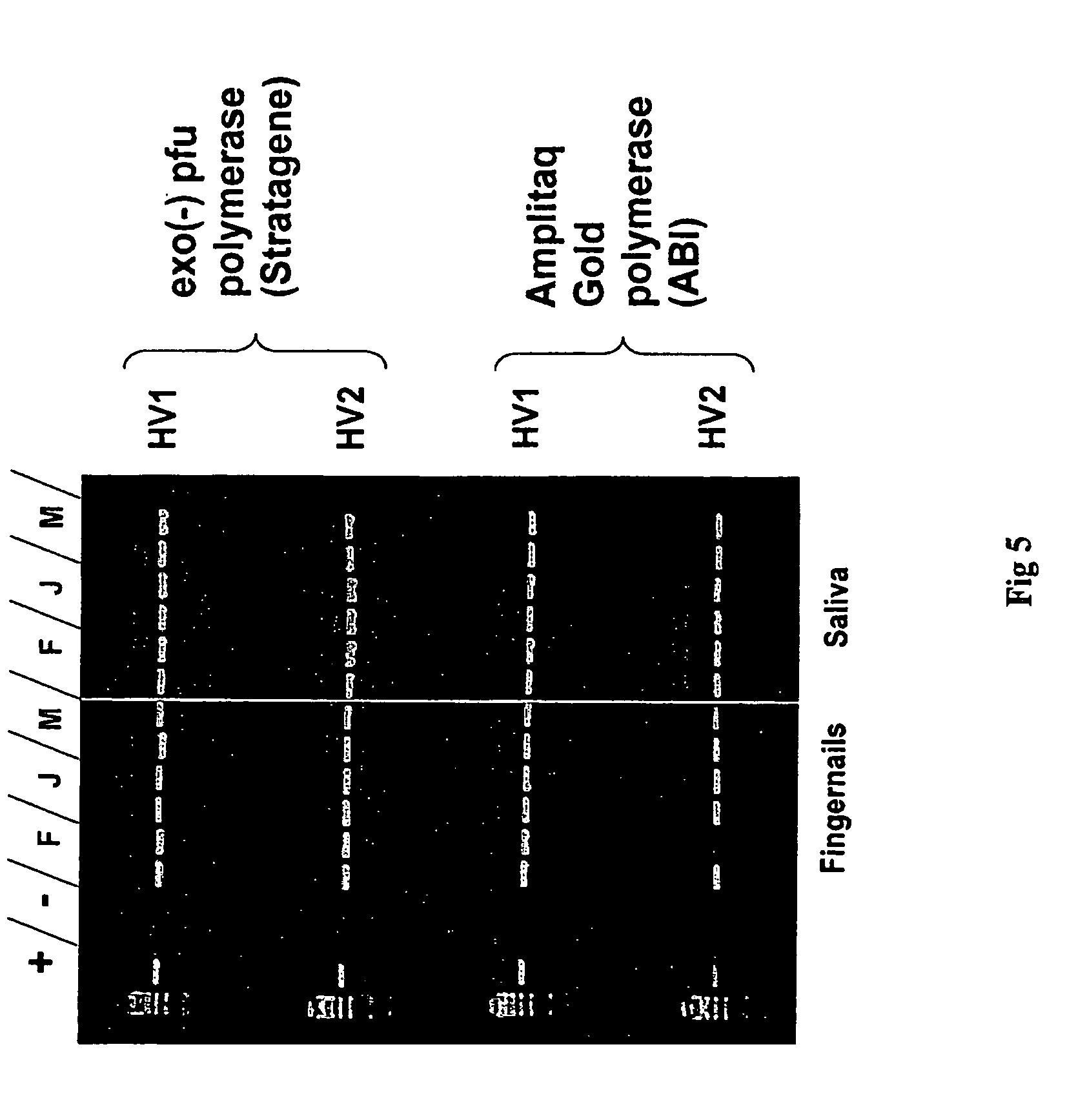 an analysis of gene patenting in the dna of gmos The wish to analyze and share such an important issue is at the origin of this cisgenic techniques (genes introduced into the dna of the plant come from the same on the other hand, in the case of gmos, legal patent protection prevents. an analysis of gene patenting in the dna of gmos The wish to analyze and share such an important issue is at the origin of this cisgenic techniques (genes introduced into the dna of the plant come from the same on the other hand, in the case of gmos, legal patent protection prevents.