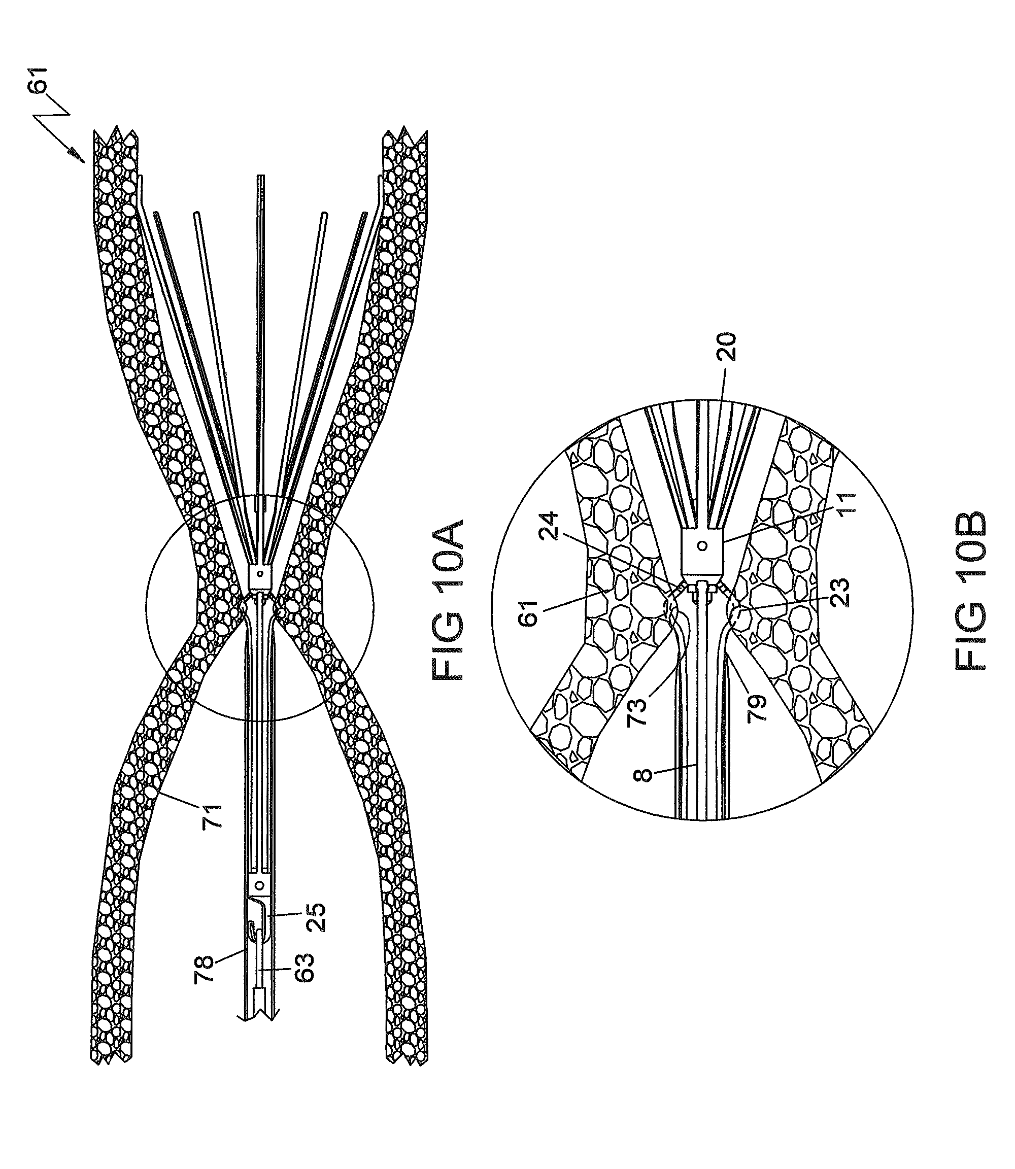 retrievable blood clot filter