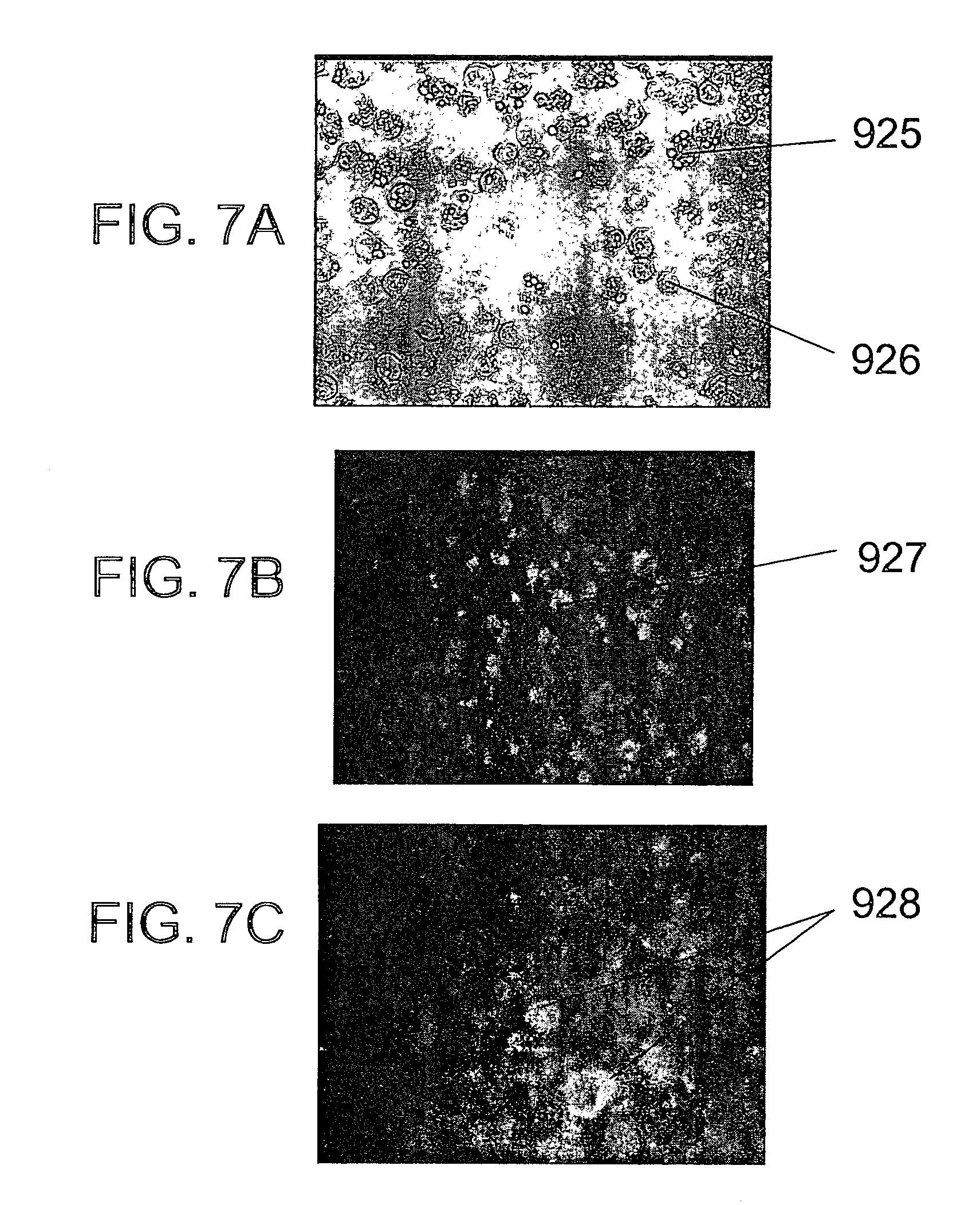 Patent US8637045 - Therapy for lysosomal enzyme deficiencies - Google