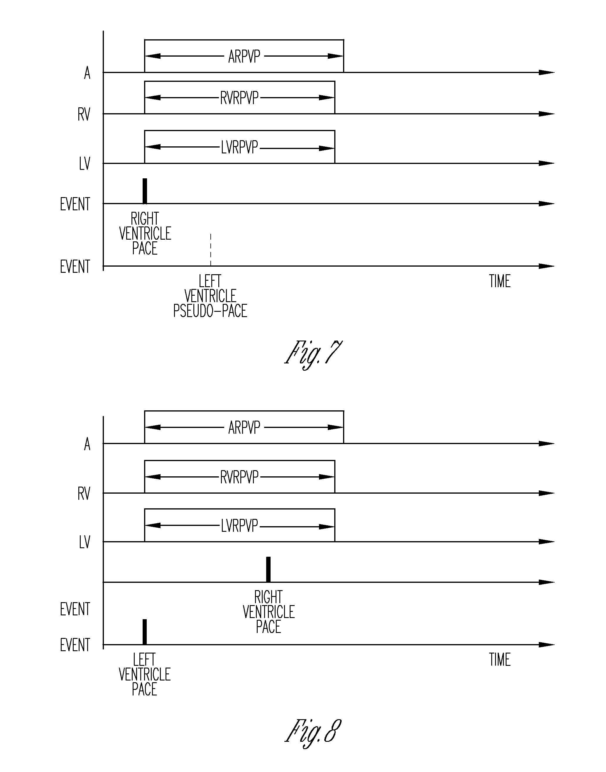 cardiac rhythm management devices essay cardiac rhythm management devices essay