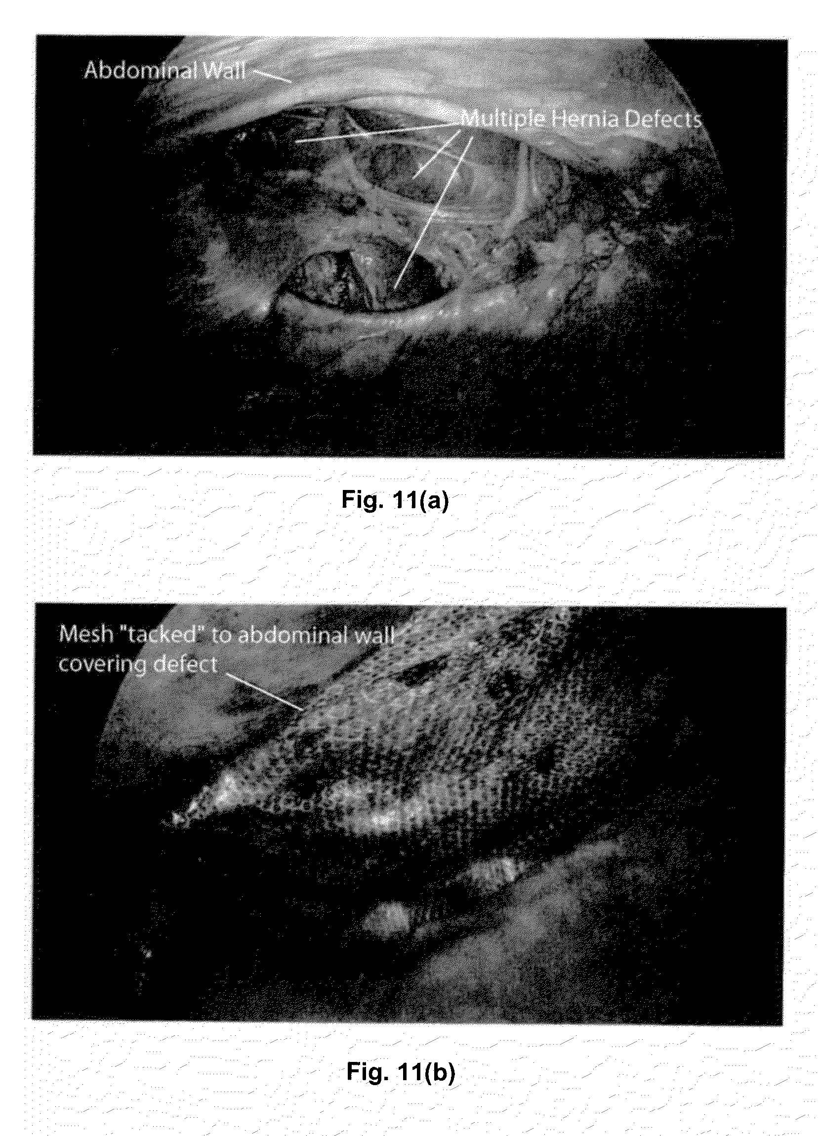 ph 57 pillole dimagranti traya ph 57 pillole dimagranti traya