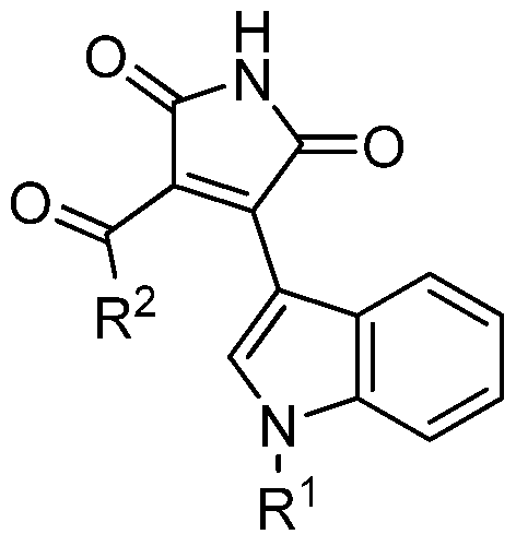 inhibidores de la glucógeno sintasa quinasa 3 diabetes mellitus