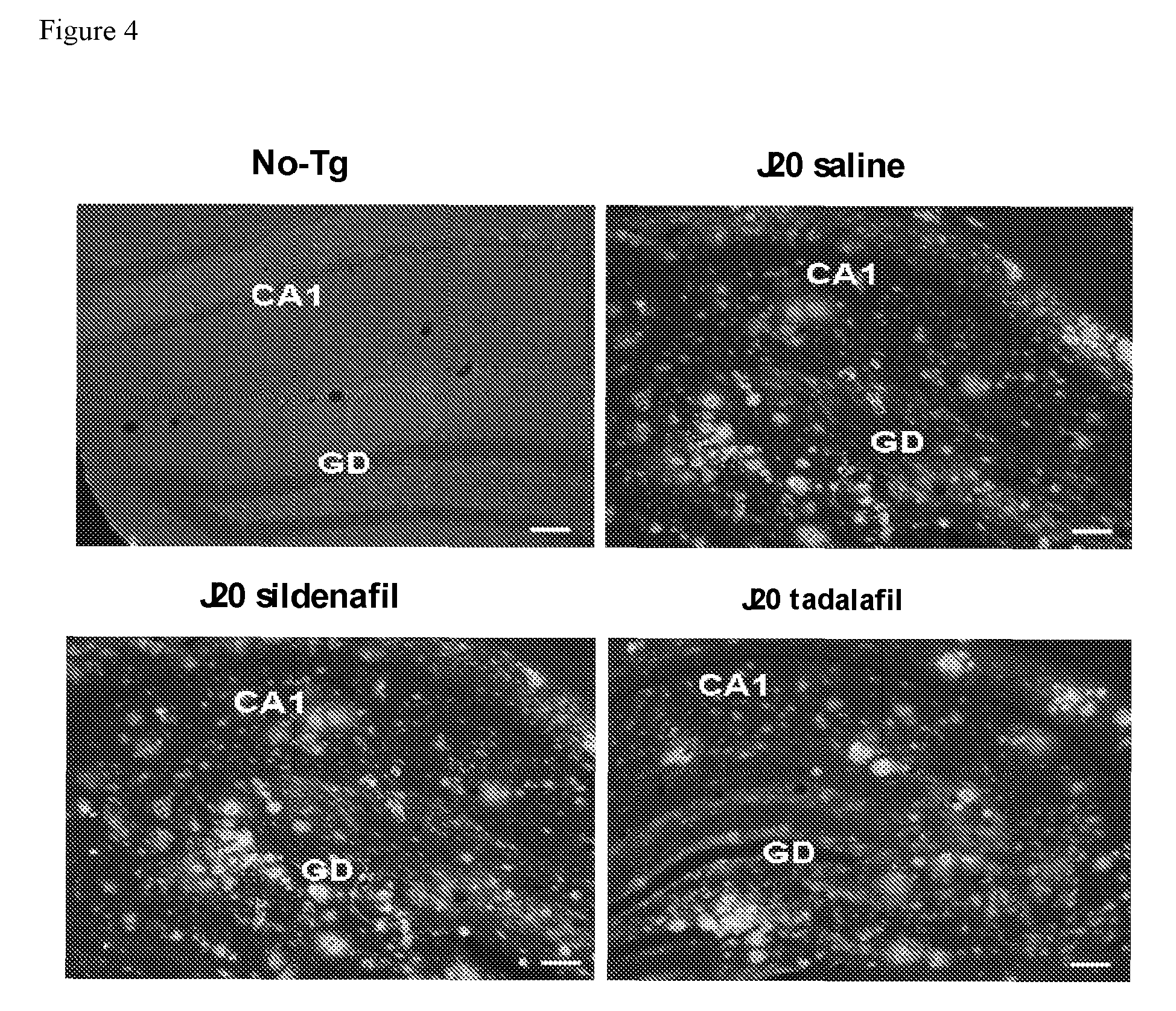 EP2535049A1 - Tadalafil for the treatment of dementia - Google Patents