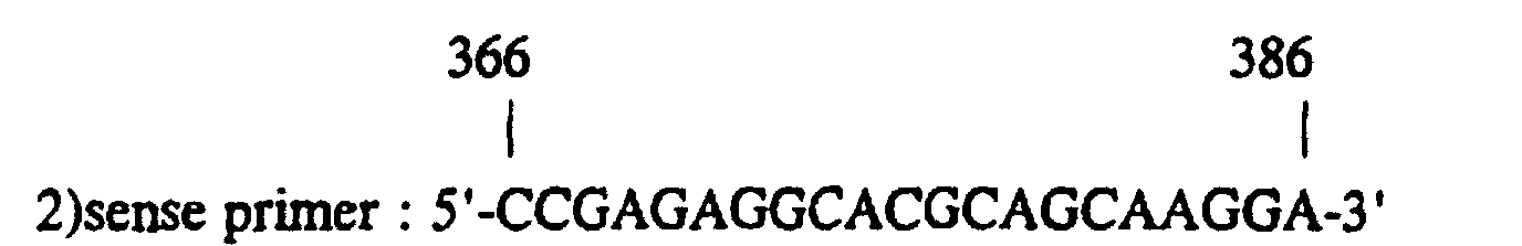 Figure 00120001