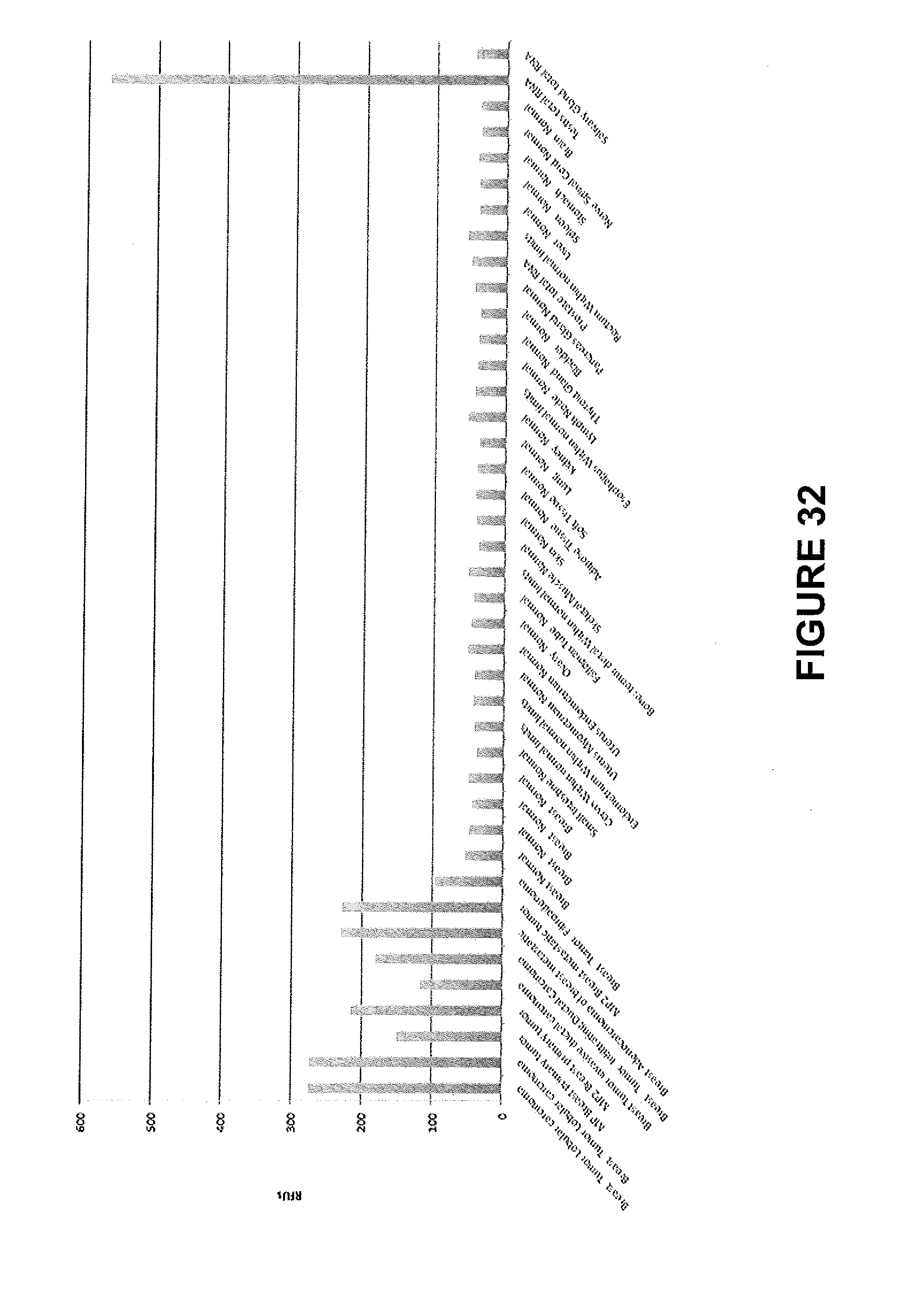 adenoma de próstata de michigan vss