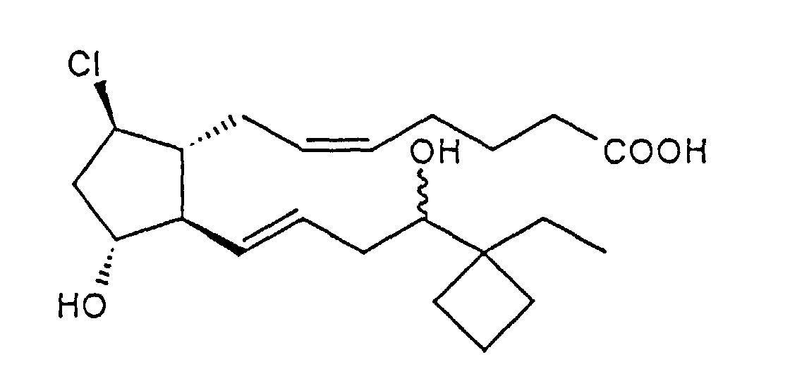 Figure 01250002