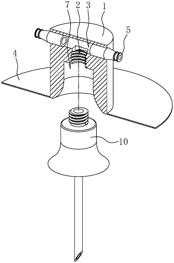 Figure 202320568762