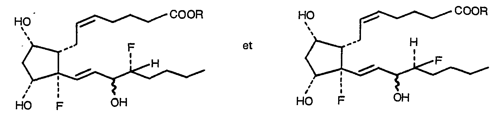 Figure imgb0004