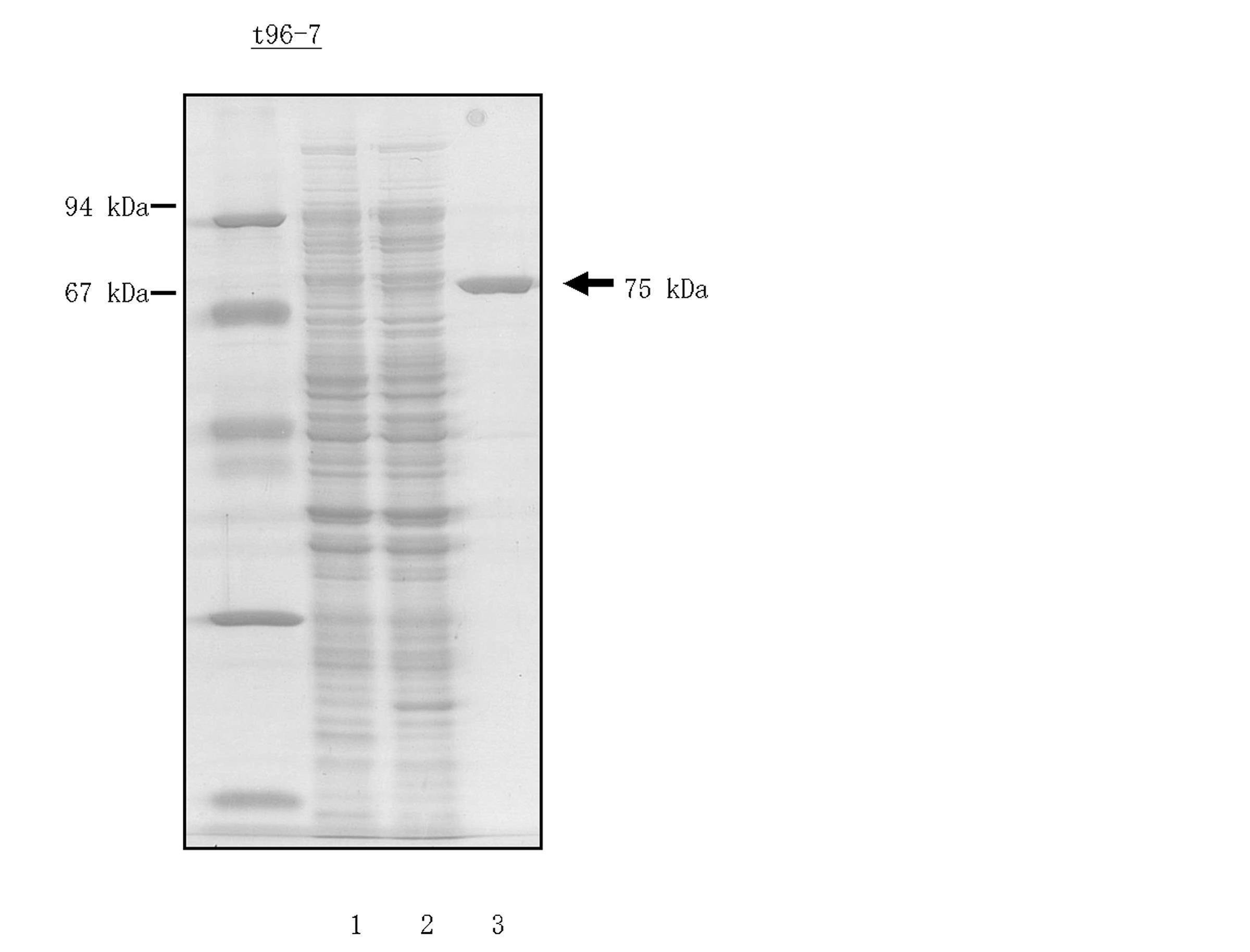 wo2011055737a1 耐熱性鎖置換型dnaポリメラーゼ及び該dnaポリメラーゼの生産方法 google patents