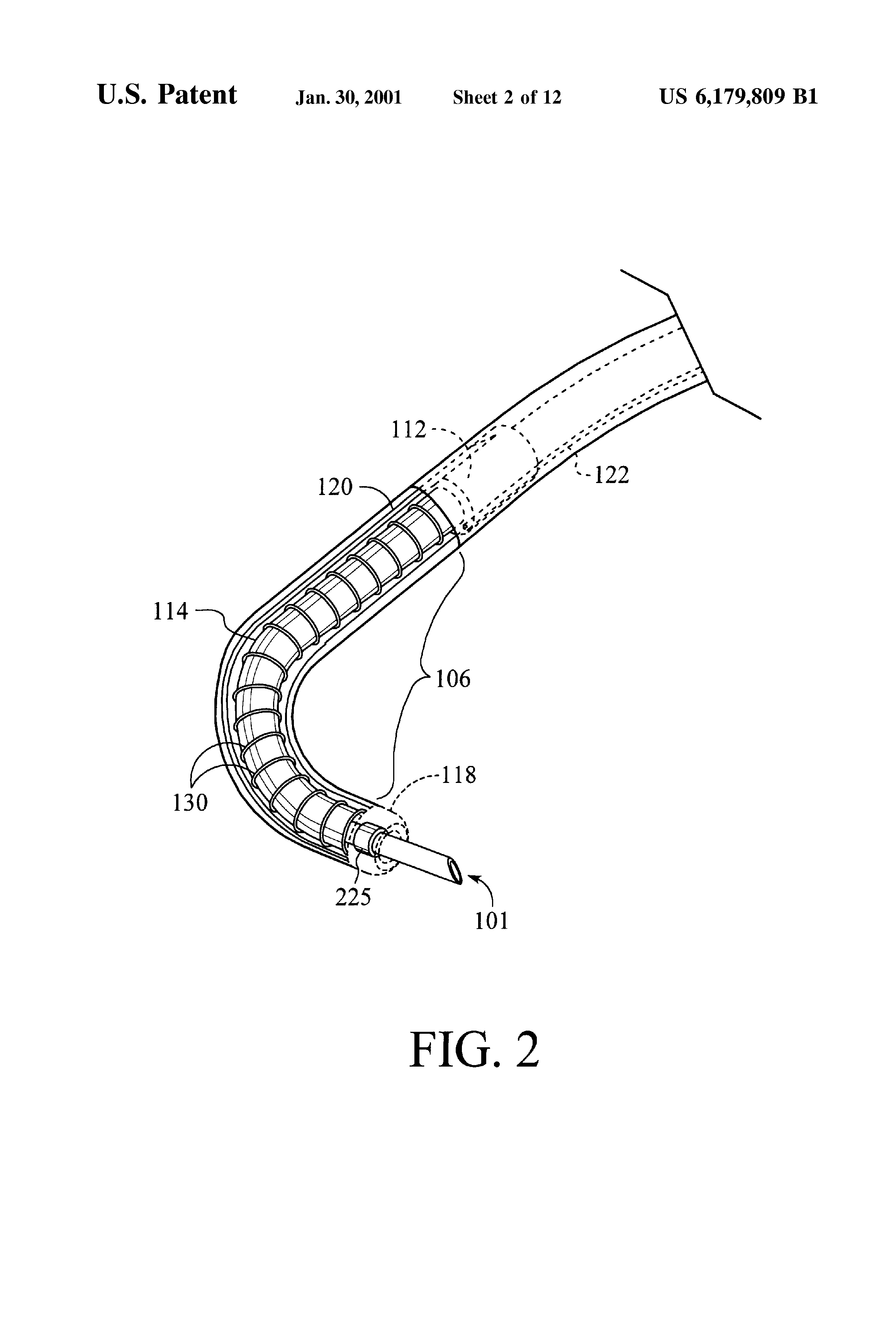 Usb1 Drug Delivery Catheter With Tip Alignment Google Patents