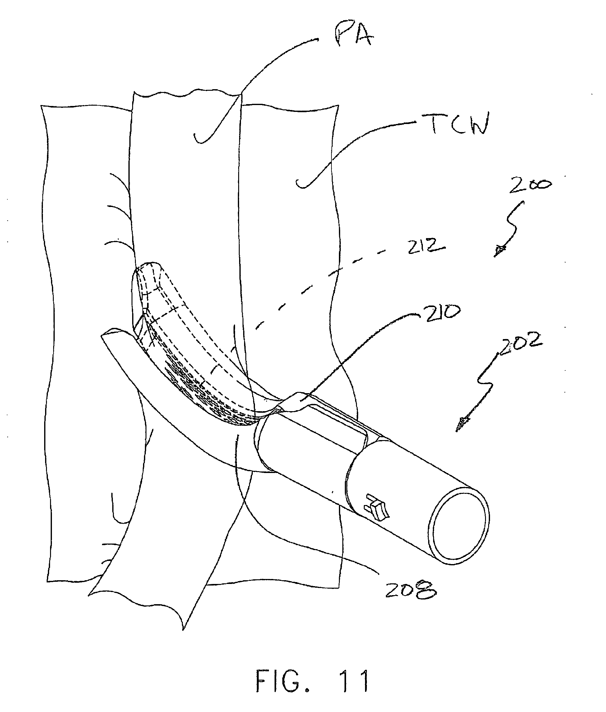Epa1 Surgical Stapling Device Having Supports For A Flexible Drive Mechanism Google Patents