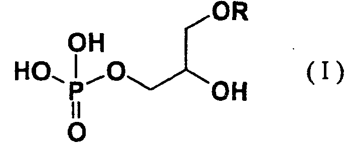 Figure 00010001