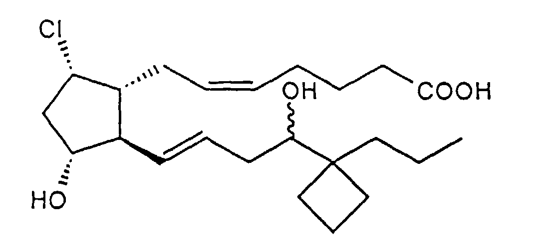 Figure 01330001