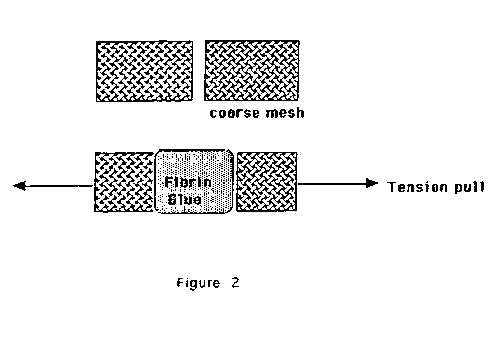 Polypeptide und Protein zur Gewichtsreduktion Polypeptide und Protein zur Gewichtsreduktion