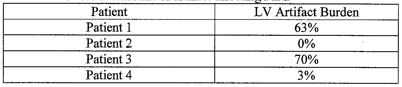 Figure imgf000011_0001
