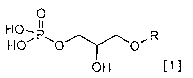 Figure 00050001