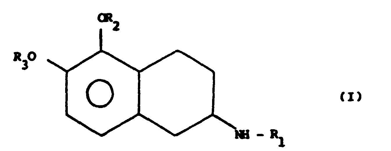 Figure 00010001