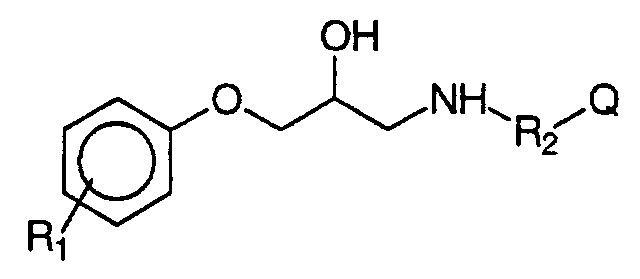 Figure 00170001