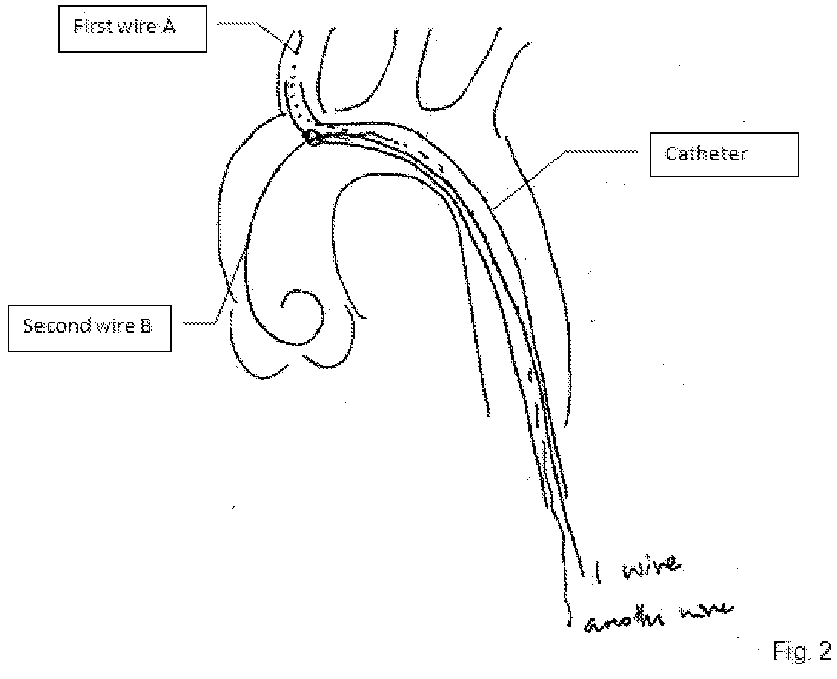 Figure imgf000016_0001